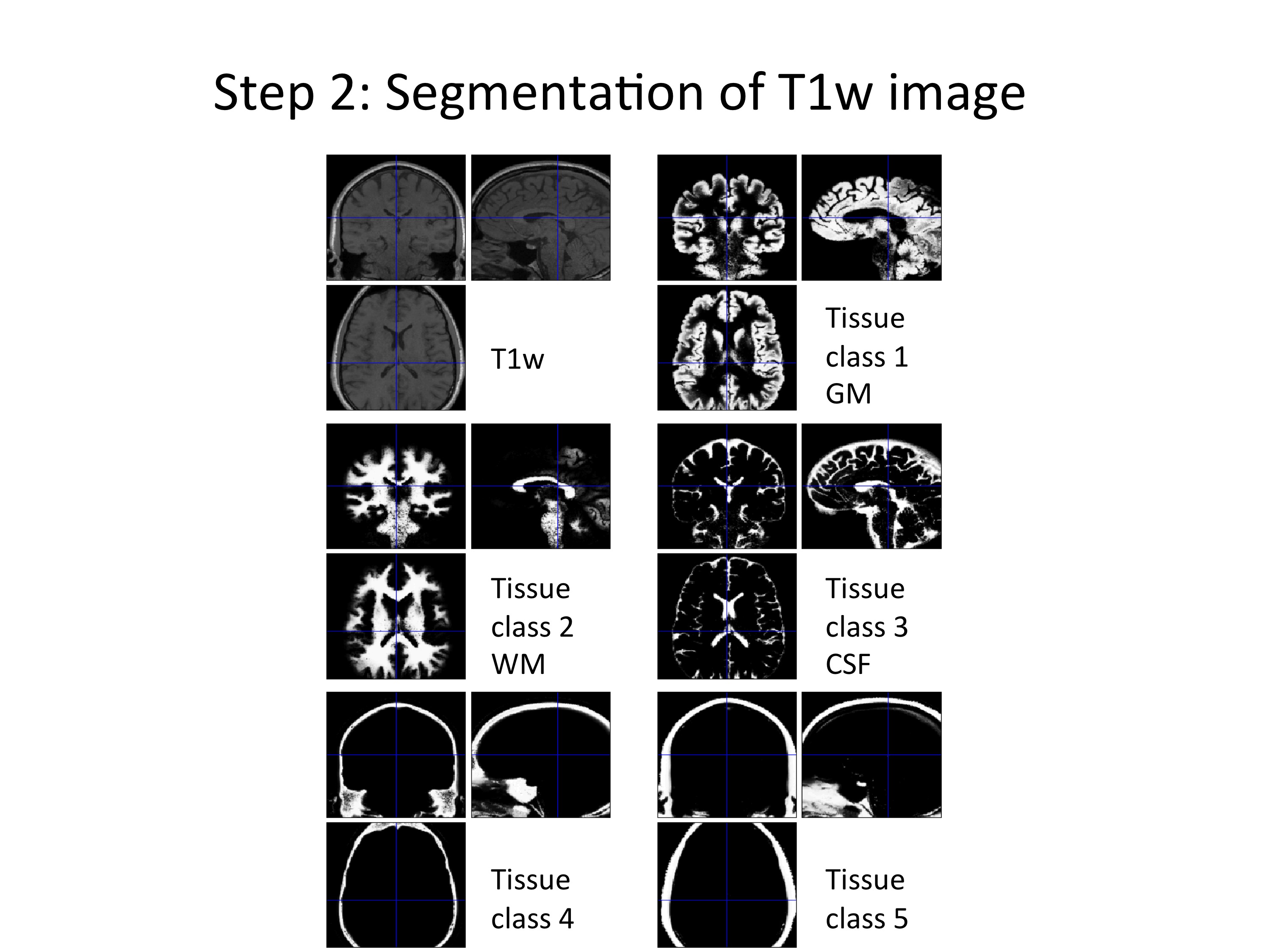 Segmentation of T1w image