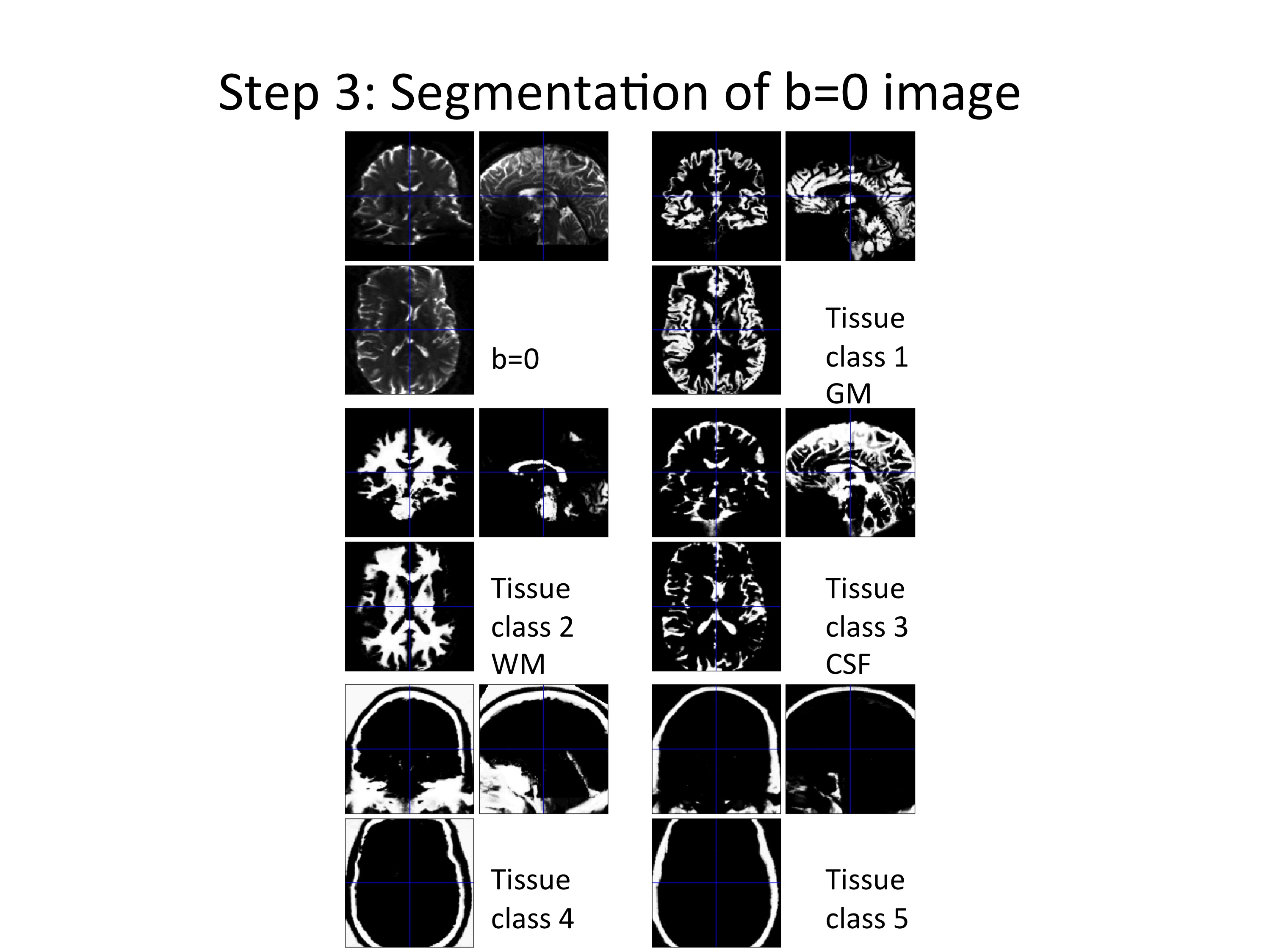 Segmentation of b=0 image